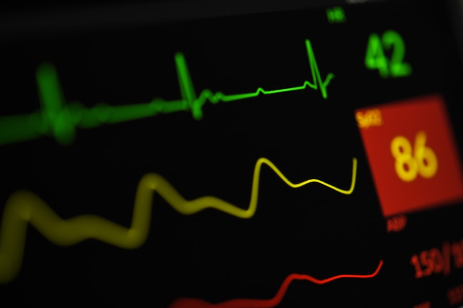 Close-up of a cardiac monitor heartbeat trace