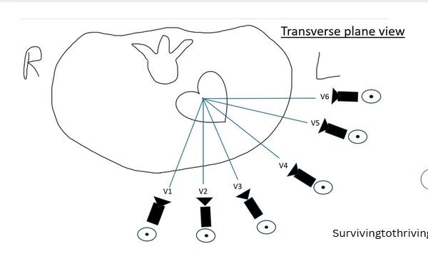 Transverse plane view — V1 to V6 lead positions on the chest