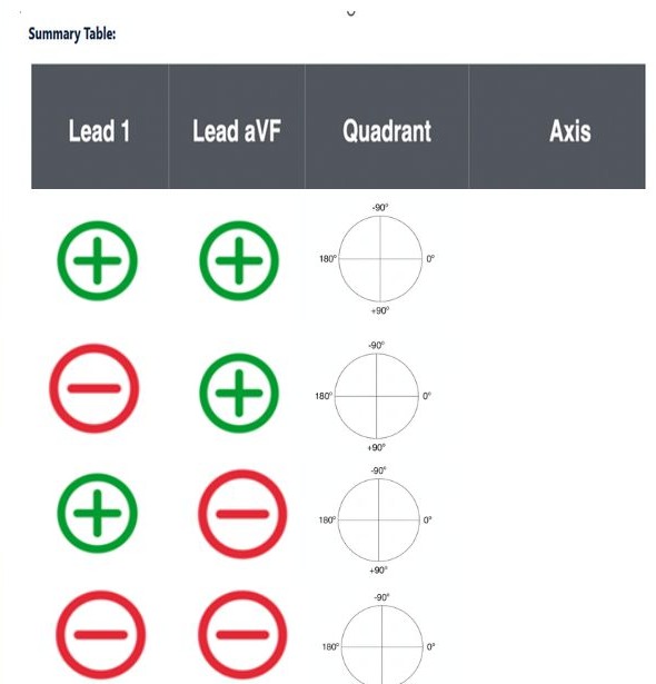 Lead I and aVF quadrant summary table